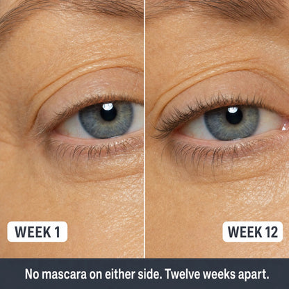 Eyelash Growth Serum